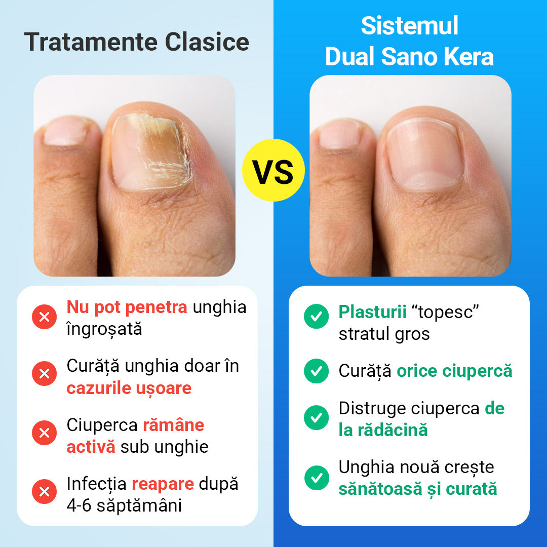 Pachet cosmetic pentru igiena unghiilor 