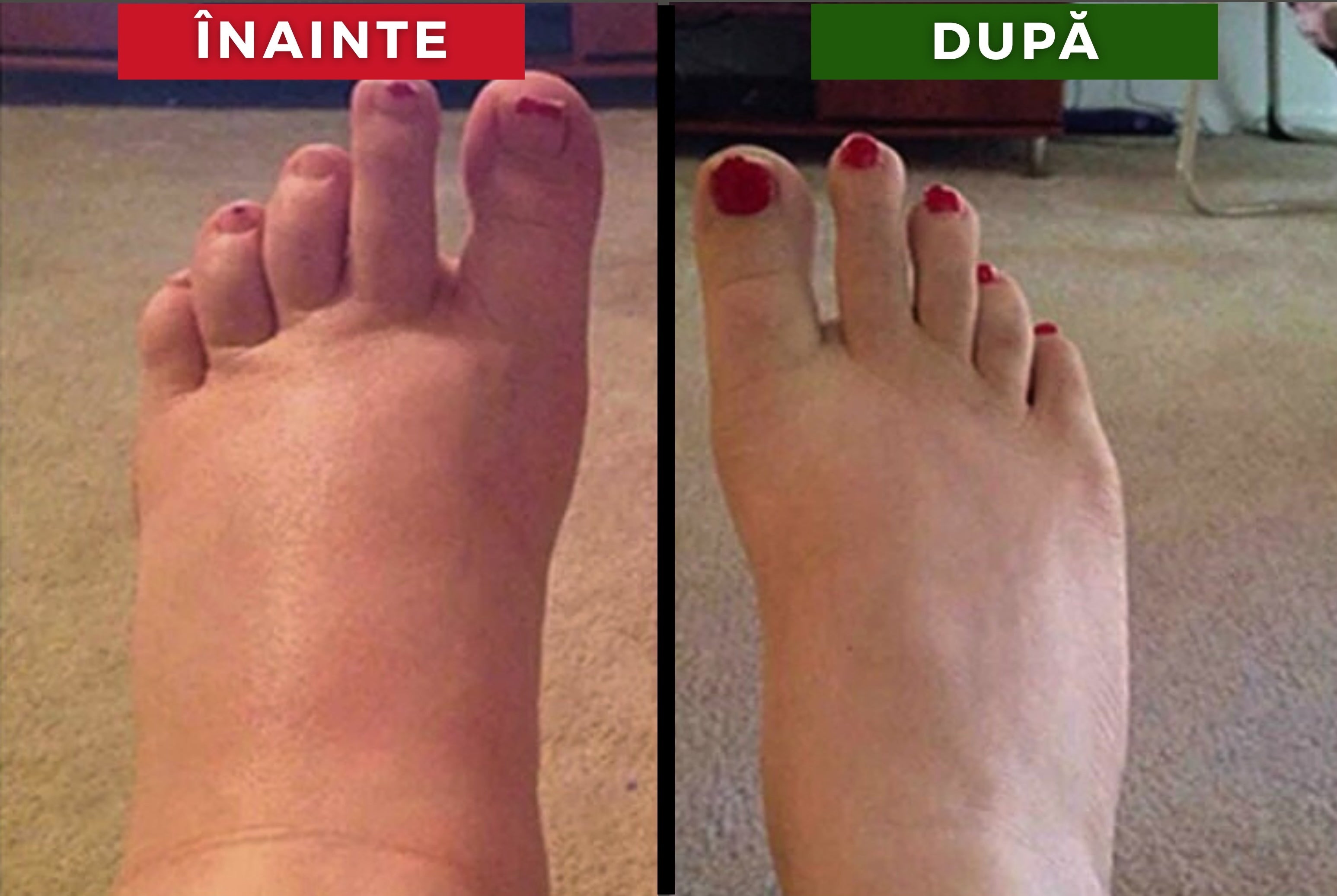 Sosete de compresie