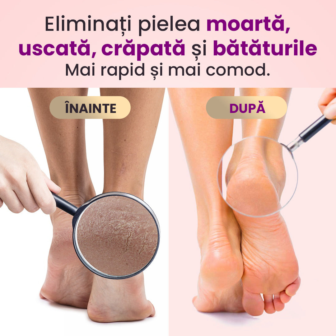 Aparat curățare pielea moartă