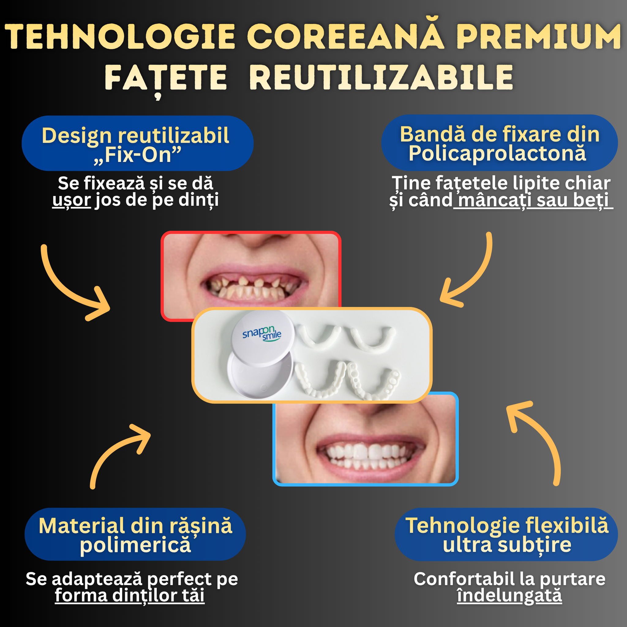 Fațete reutilizabile universale